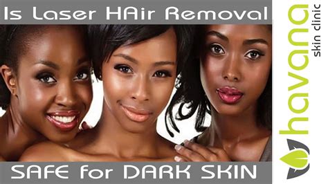 Cool Laser Hair Removal Dark Skin London 2022 Stylefer