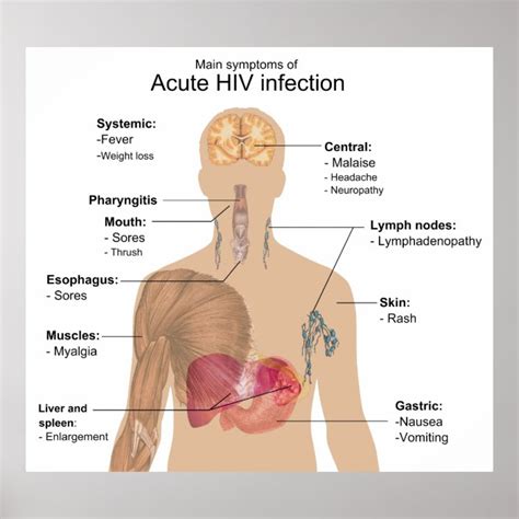 main symptoms of acute hiv infection poster