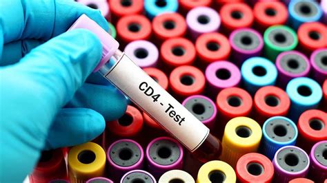 Twelve Steps To Cd4 Testing What Is Cd4 Testing