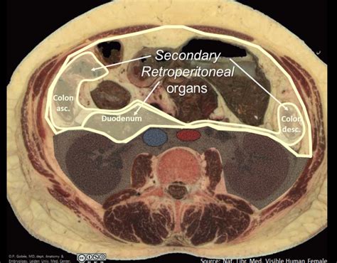 Create your own flashcards or choose from millions created by other students. Secondary Retroperitoneal | AnatomyTOOL