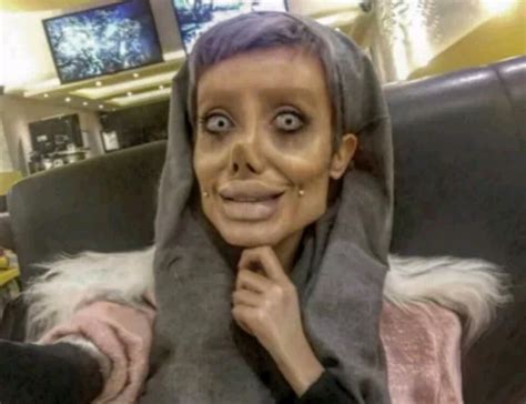 Girl Just Wants To Look Like Angelina Jolie But Surgery