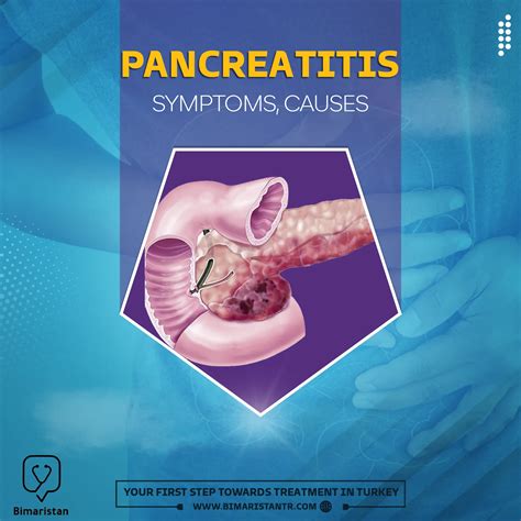 Symptoms Of Acute And Chronic Pancreatitis With Its Causes Bimaristan