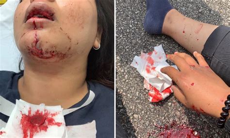In response to queries by cna, the police said it was alerted to an accident. Female rider appealing for video footage after accident ...