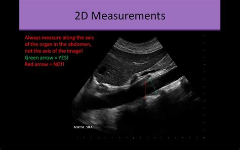 Abdominal Ultrasound Registry Review