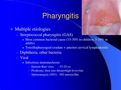 Ppt Antibiotics And Infectious Disease In Otolaryngology Hns