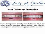 Dental Treatment Offers Pictures
