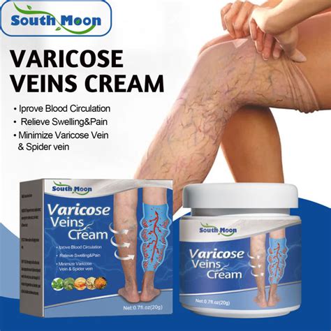 South Moon Varicose Veins Treatment Cream Relieve Legs Tired Dilated