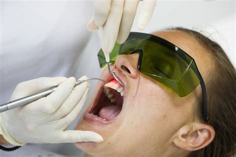 Laser Gum Sterilization Laser Treatment For Gum Infection