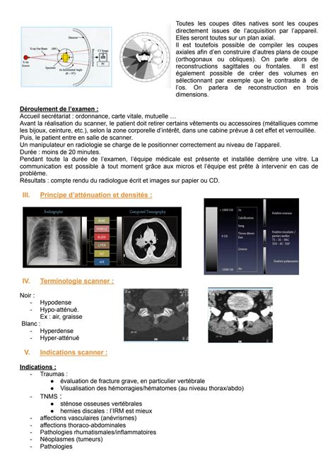 SOLUTION Chapitre 3 Tomodensitom Trie Tdm Scanner Computed Tomographie