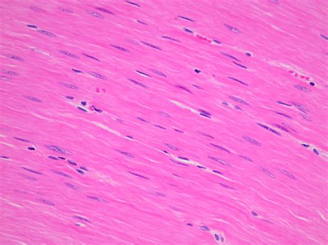 Smooth Muscle Histology Intestine Section In 2020 His