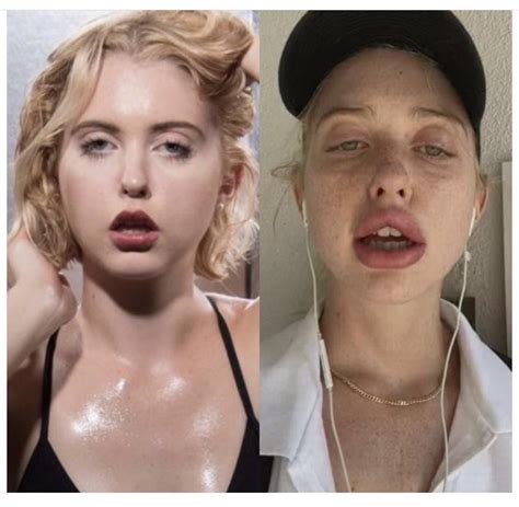 Chloe Cherry Before And After Pics Rredscarepod
