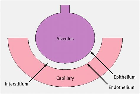 How To Investigate A Patient With Suspected Interstitial Lung Disease