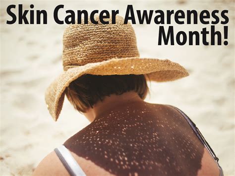 The Oachc Informer Skin Cancer Prevention