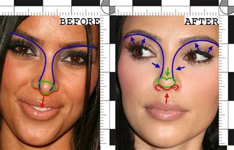 Kim Kardashians Nose Job A Forensic Analysis Rawnsley Plastic Surgery