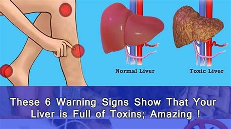 These 6 Warning Signs Show That Your Liver Is Full Of Toxins Amazing