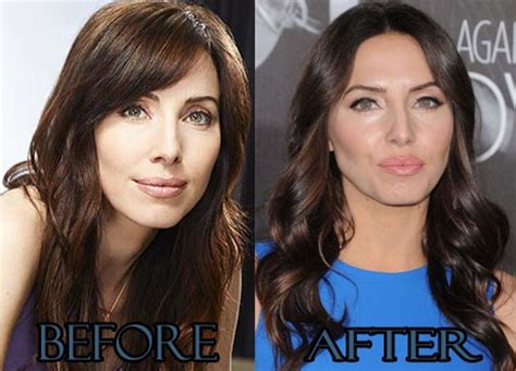 Whitney Cummings Plastic Surgery Nose Job Before And After Photos
