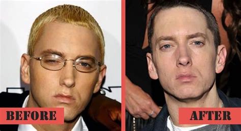 Eminem Before And After