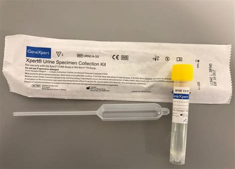 Chlamydiagc Pcr Urine Mercyone Laboratory Test Catalog