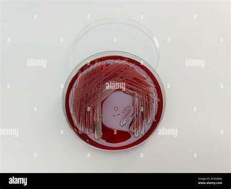 A Staphylococcus Aureus Bacteria Displayed On Blood Agar Plate On A