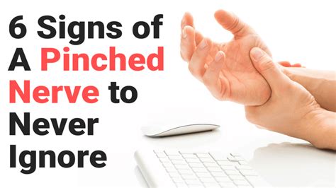 6 Signs Of A Pinched Nerve To Never Ignore