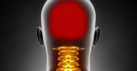 How Neck Pain And Headache Can Occur Together
