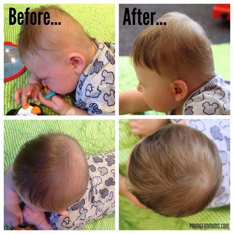 Physical Therapy For Baby Head Shape For Sale Off 65 46 Off