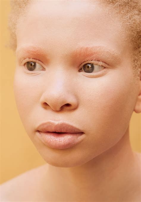 African Albino Model