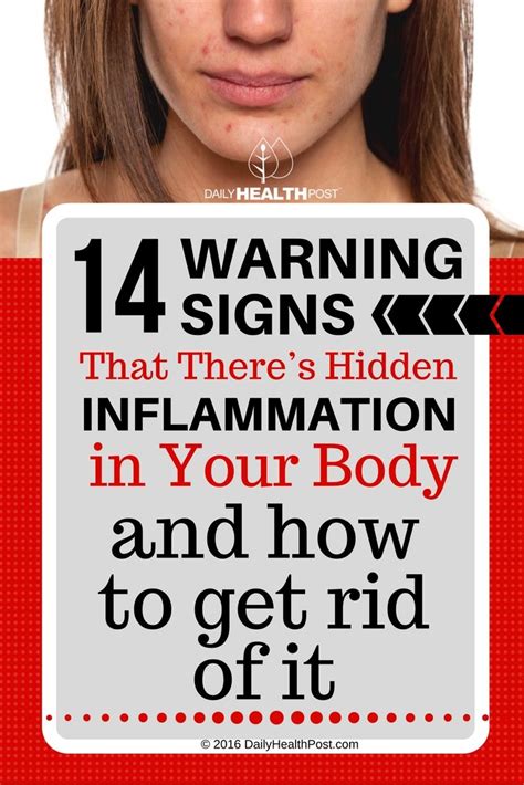 14 Warning Signs That Theres Hidden Inflammation In Your Body And How
