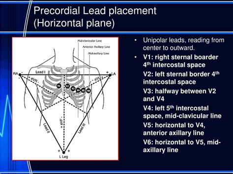 Ppt Intraoperative Ecg Lead Placement Powerpoint