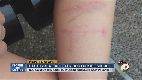 Little Girl Attacked By Dog Outside School Youtube