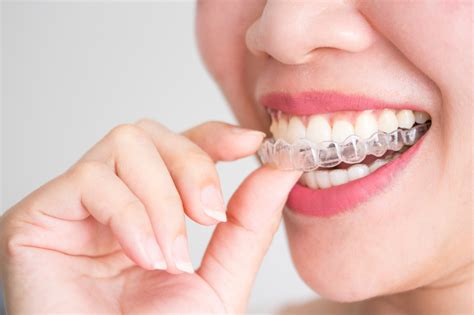 How To Properly Take Care Of Your Invisalign Aligners Alpha Dental Clinic