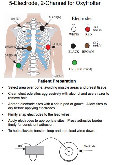 Holter Monitor 5 Lead Placement Diagram