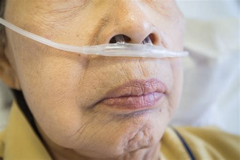 Higher Eosinophil Count In Copd Patients Associated With Pneumonia