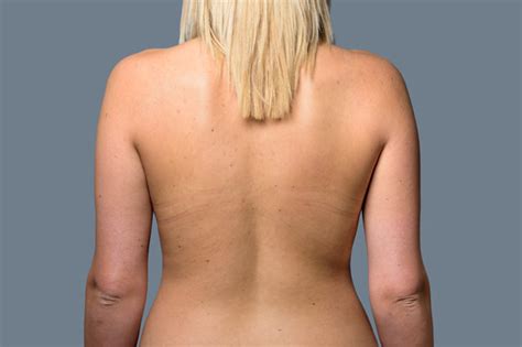 Average Nude Womans Body Pics Best Porno