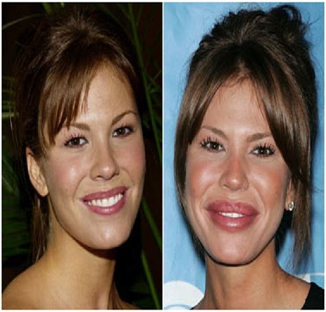 Top 18 Celebs With Plastic Surgery