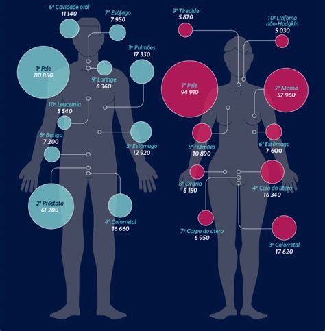 Os Tipos De Câncer Mais Comuns Nas Mulheres E Nos Homens Veja Saúde