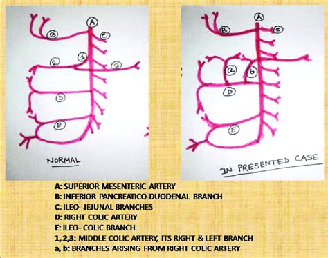 Superior Mesenteric Artery And Its Branches Download Scientific Diagram