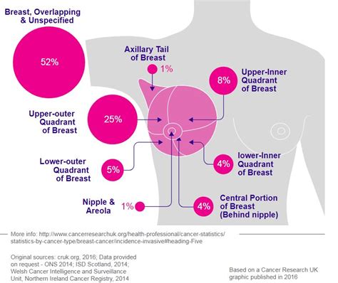 Wmnf Breast Cancer Info By Cancer Research Uk Wmnf