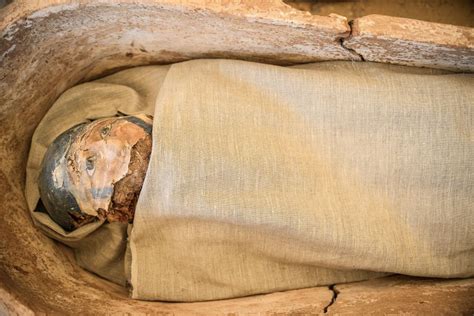 mummified fetus found inside mom s womb as it started to ‘pickle within the abdomen of its