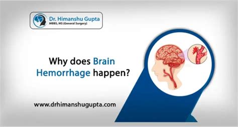 Brain And Spine Surgeon In Jaipur Dr Himanshu Gupta Neurosurgeon