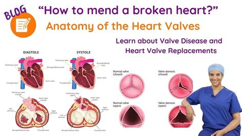 Heart Valve Anatomy Valve Disease And Heart Valve Replacement