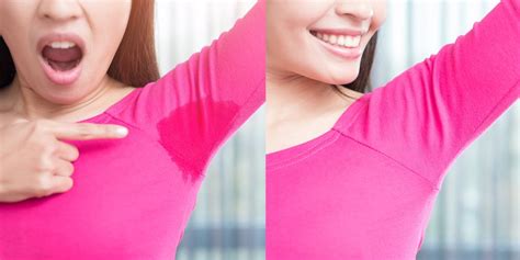 Manage Excessive Underarm Sweating Near Me Torrance Ca — Lumier Medical