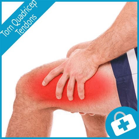 How Torn Quadricep Tendons Can Affect Your Knee Health My Knee Doc
