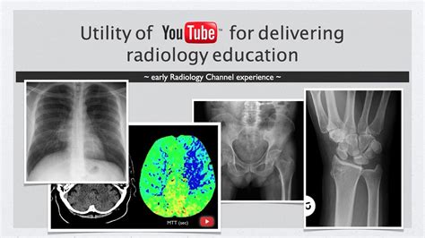 Youtube And Radiology Education The Early Radiology Channel