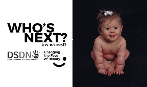 Chapter 1 Part 2 — Down Syndrome Prenatal Testing