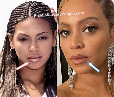 Beyonce Before And After 2022