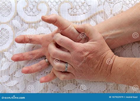 A Woman With Parkinson`s Disease Has Her Hands Shaking Stock Image