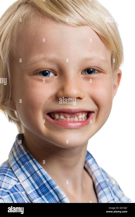 Cute Boy With Missing Front Teeth Stock Photo Alamy