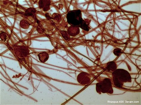 We did not find results for: Rhizopus up close and personal