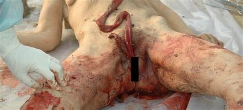 超閲覧注意マ コから腸を出されその腸で絞め殺された女性が発見される画像 ポッカキット